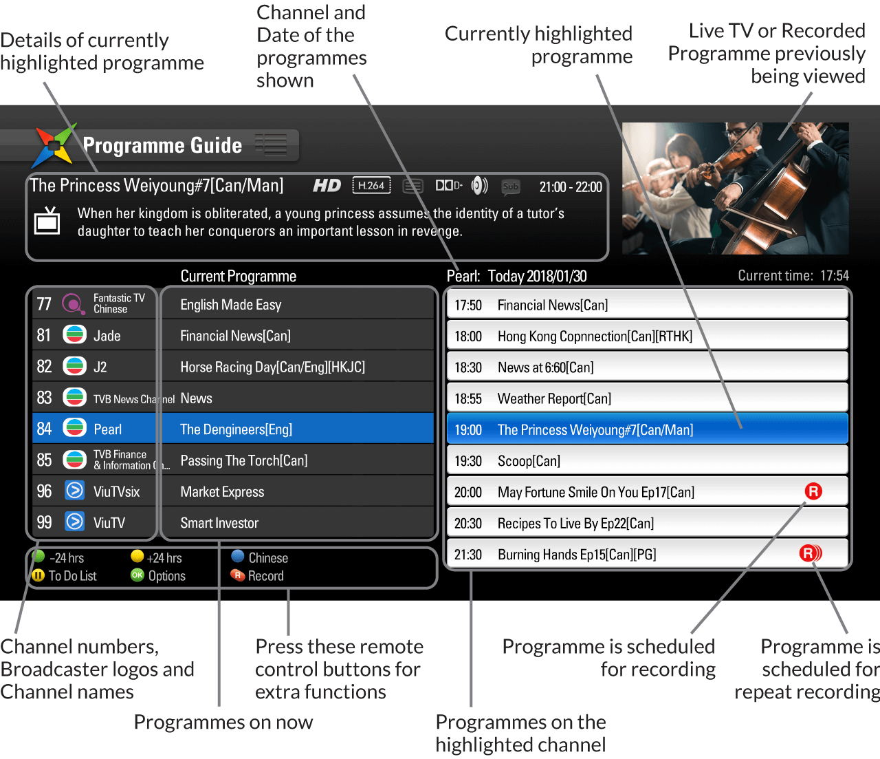 Vertical EPG
